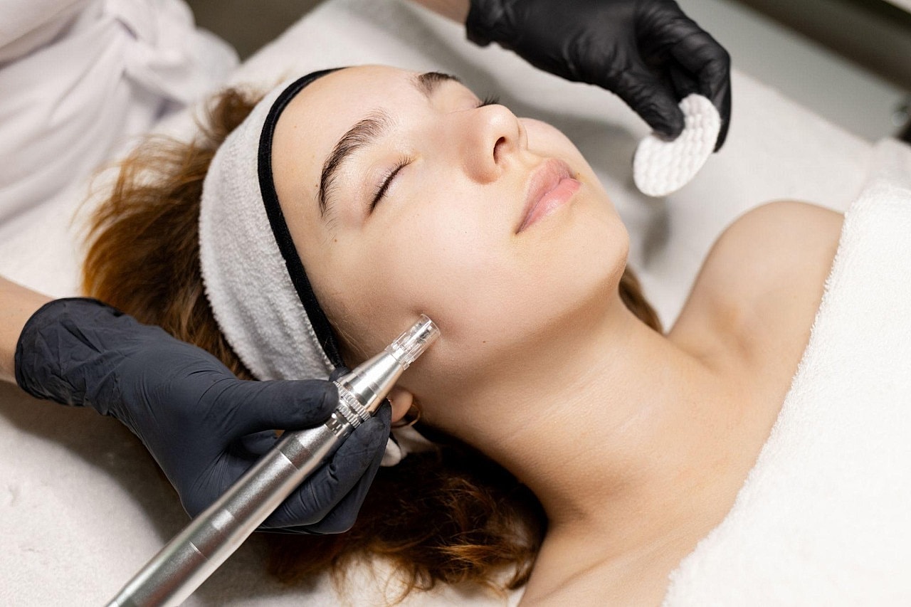 How Does Microneedling Help Skin Look Smoother?