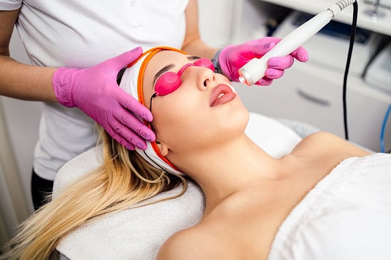 Who Is an Ideal Candidate for Facial Laser Hair Removal?