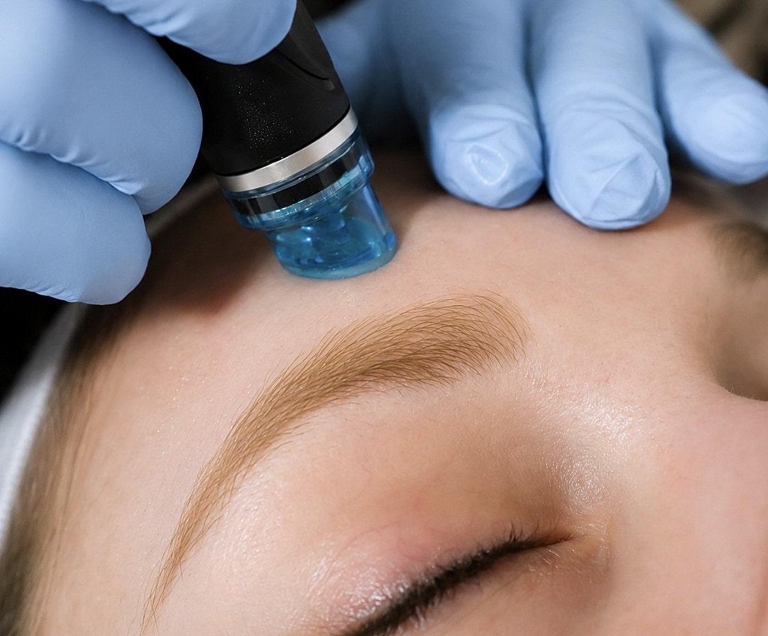 Personalized Med Spa Treatments Near Medina, WA With a Clear Plan