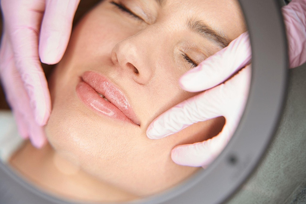 Benefits We Love About Radiesse